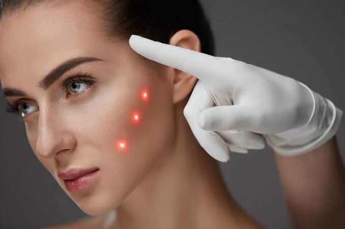 Skin laser renewal