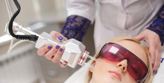 A laser renewal principle